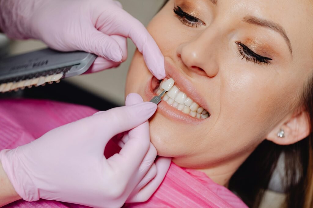 Miami best veneers, cheap good veneers Miami of a dental veneer being applied to a woman's teeth at a clinic.