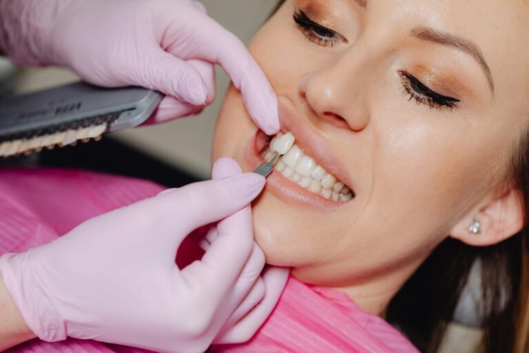 Miami best veneers, cheap good veneers Miami of a dental veneer being applied to a woman's teeth at a clinic.