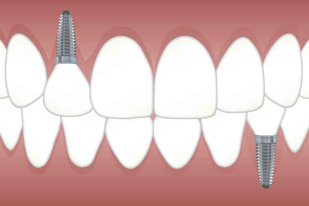 teeth whitening miami best dentist straight teeth white teeth perfect teeth beautiful smile veneers implant