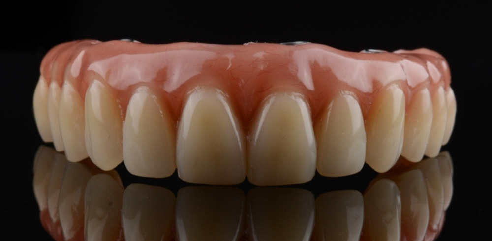 bridge teeth whitening miami best dentist straight teeth white teeth perfect teeth beautiful smile veneers implant all on x