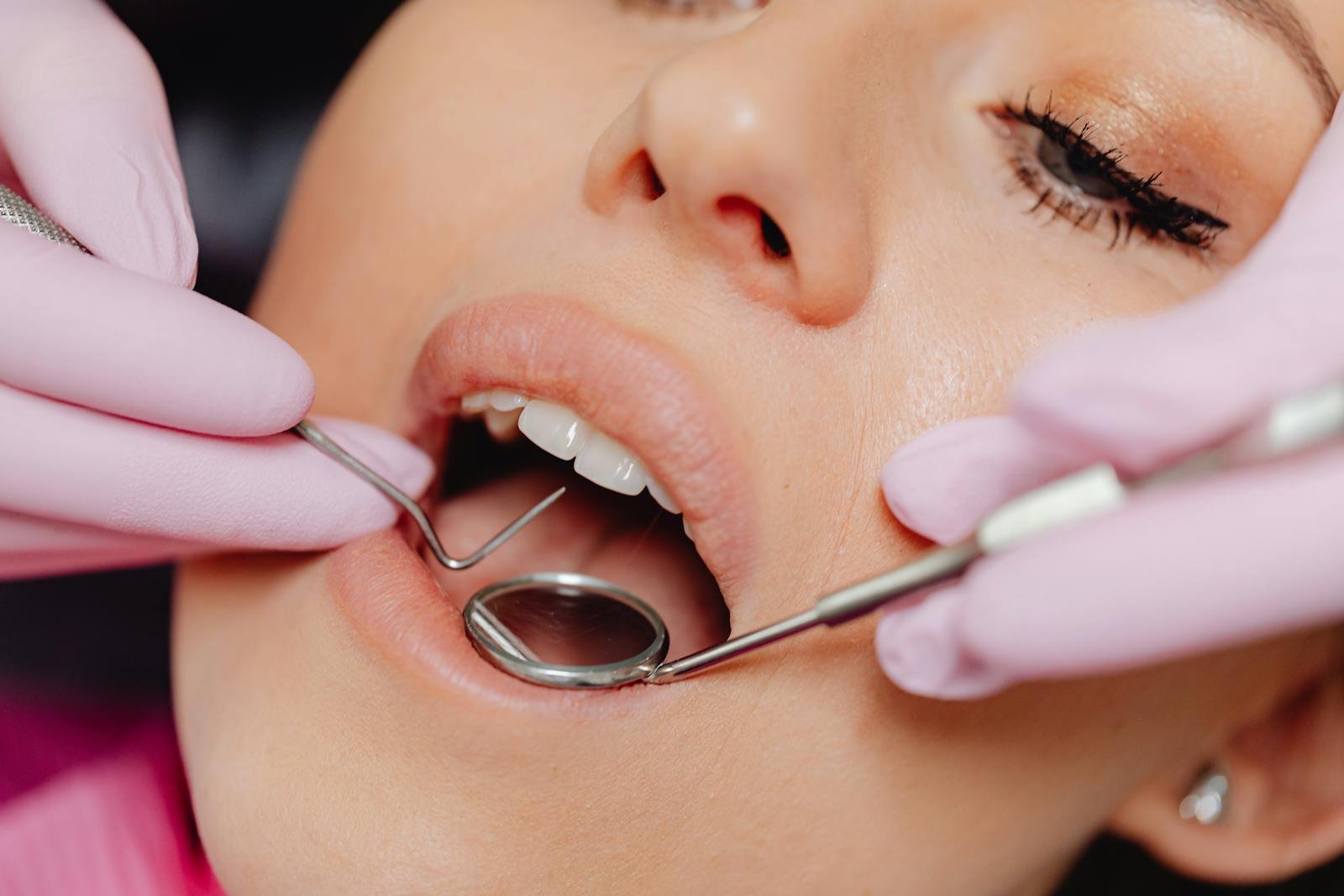 teeth whitening miami best dentist straight teeth white teeth perfect teeth beautiful smile veneers implant all on x
