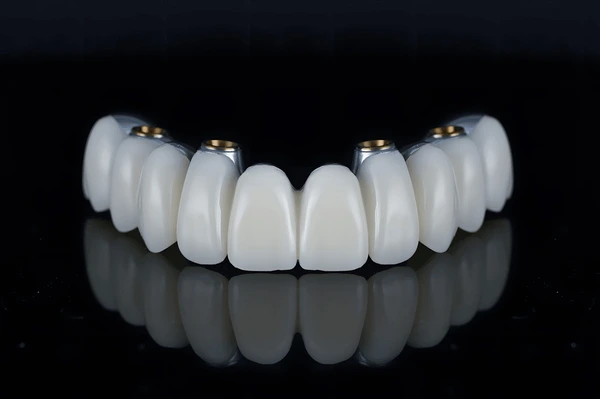 bridge teeth whitening miami best dentist straight teeth white teeth perfect teeth beautiful smile veneers implant all on x