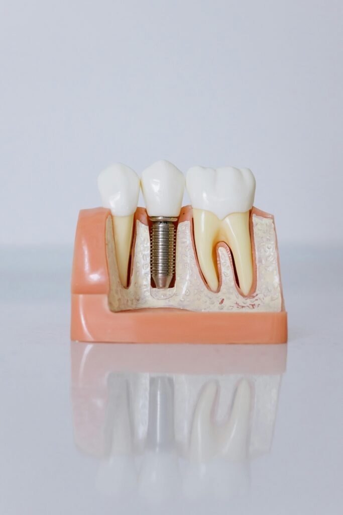teeth whitening miami best dentist straight teeth white teeth perfect teeth beautiful smile veneers implant