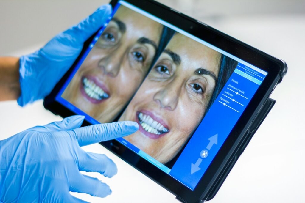 miami best veneers dentist white teeth smile design Hollywood smile