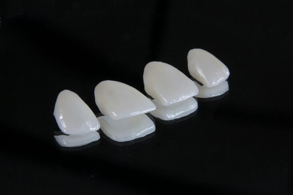 miami best veneers dentist white teeth smile design Hollywood smile