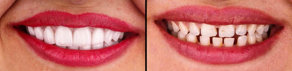 240_F_315714974_xgnDc7knHEd0W7AGzJyI6hu8sBmIrs5f