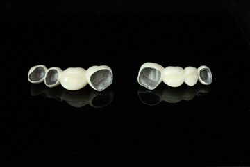 bridge crowns Invisalign clear aligners teeth reshaping gummy smile botox bonding teeth whitening miami best dentist straight teeth white teeth perfect teeth beautiful smile veneers smile design veneers