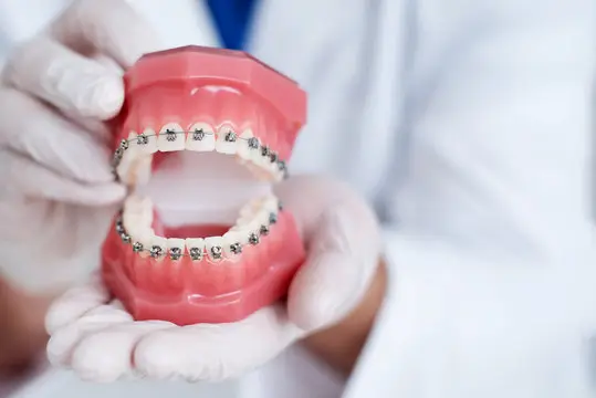 braces extraction tooth extract pulled out partial dentures removable root canal dentures composite resin inlay onlay bridge crowns Invisalign clear aligners teeth reshaping gummy smile botox bonding teeth whitening miami best dentist straight teeth white teeth perfect teeth beautiful smile veneers smile design veneers