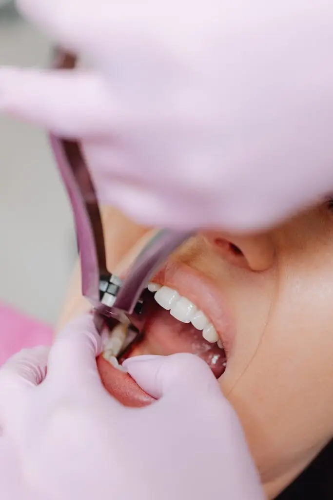 extraction tooth extract pulled out partial dentures removable root canal dentures composite resin inlay onlay bridge crowns Invisalign clear aligners teeth reshaping gummy smile botox bonding teeth whitening miami best dentist straight teeth white teeth perfect teeth beautiful smile veneers smile design veneers