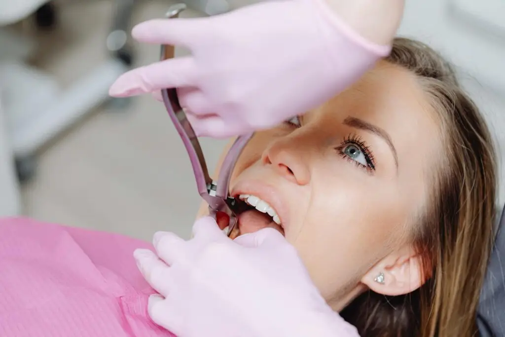 extraction tooth extract pulled out partial dentures removable root canal dentures composite resin inlay onlay bridge crowns Invisalign clear aligners teeth reshaping gummy smile botox bonding teeth whitening miami best dentist straight teeth white teeth perfect teeth beautiful smile veneers smile design veneers