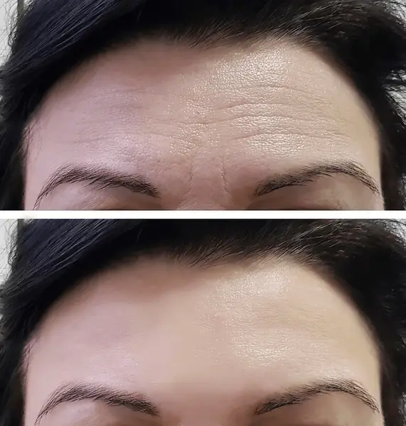 botox deep cleanning srp braces extraction tooth extract pulled out partial dentures removable root canal dentures composite resin inlay onlay bridge crowns Invisalign clear aligners teeth reshaping gummy smile botox bonding teeth whitening miami best dentist straight teeth white teeth perfect teeth beautiful smile veneers smile design veneers