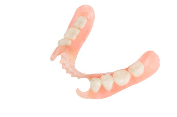 partial dentures removable root canal dentures composite resin inlay onlay bridge crowns Invisalign clear aligners teeth reshaping gummy smile botox bonding teeth whitening miami best dentist straight teeth white teeth perfect teeth beautiful smile veneers smile design veneers