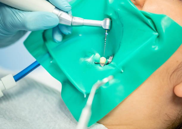 root canal dentures composite resin inlay onlay bridge crowns Invisalign clear aligners teeth reshaping gummy smile botox bonding teeth whitening miami best dentist straight teeth white teeth perfect teeth beautiful smile veneers smile design veneers