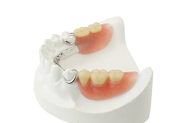 partial dentures removable root canal dentures composite resin inlay onlay bridge crowns Invisalign clear aligners teeth reshaping gummy smile botox bonding teeth whitening miami best dentist straight teeth white teeth perfect teeth beautiful smile veneers smile design veneers