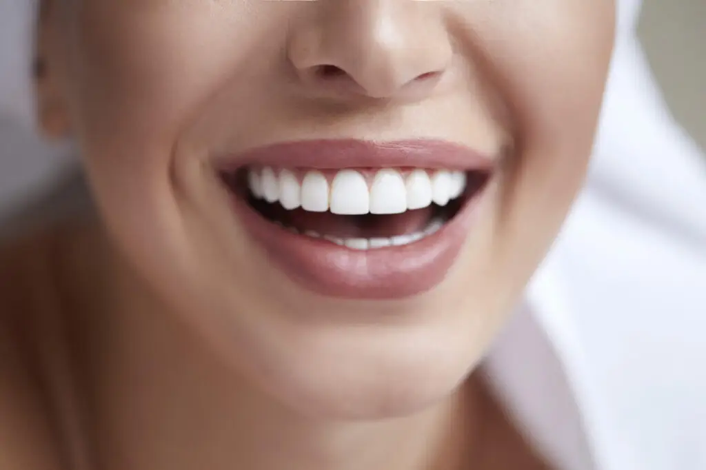 deep cleanning srp braces extraction tooth extract pulled out partial dentures removable root canal dentures composite resin inlay onlay bridge crowns Invisalign clear aligners teeth reshaping gummy smile botox bonding teeth whitening miami best dentist straight teeth white teeth perfect teeth beautiful smile veneers smile design veneers