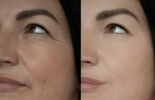 dermal fillers botox deep cleanning srp braces extraction tooth extract pulled out partial dentures removable root canal dentures composite resin inlay onlay bridge crowns Invisalign clear aligners teeth reshaping gummy smile botox bonding teeth whitening miami best dentist straight teeth white teeth perfect teeth beautiful smile veneers smile design veneers